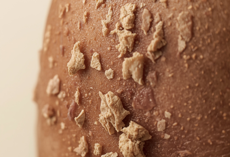 Qué es la Piel Seca: Causas, Síntomas y Cómo Cuidarla (Guía Completa 2026)